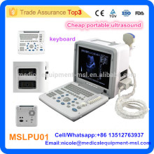 MSLPU01-I Самая дешевая больница Оборудование для ультразвукового сканера для портативных компьютеров / портативный ультразвуковой сканер